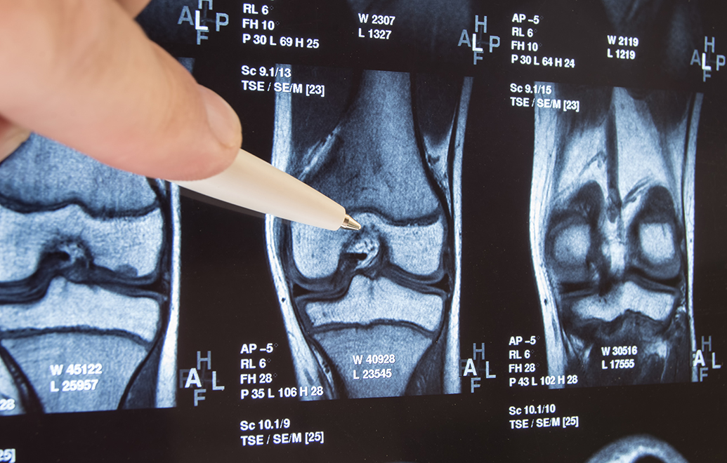 Joint X-Ray